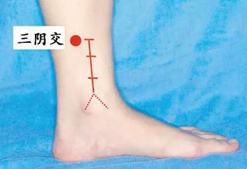 艾灸治疗失眠的穴位及操作指南
